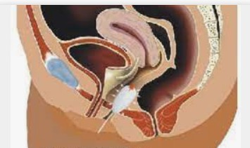 蓝冠注册会员,蓝冠招聘